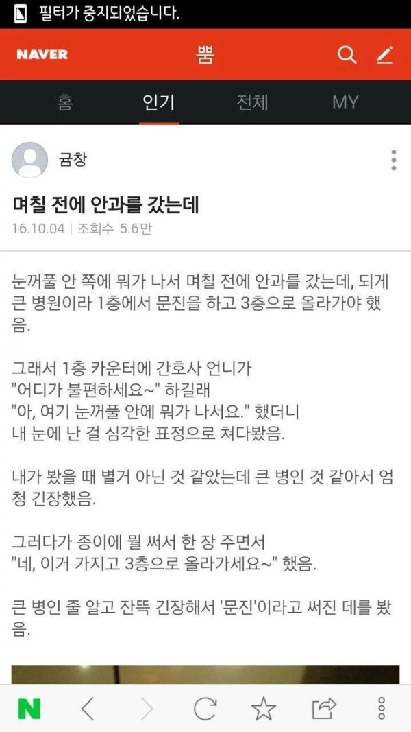 안과에 갔는데 간호사가 엄청 심각한 표정으로