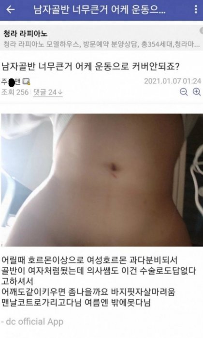 디시에 올라온 남자 골반 레전드