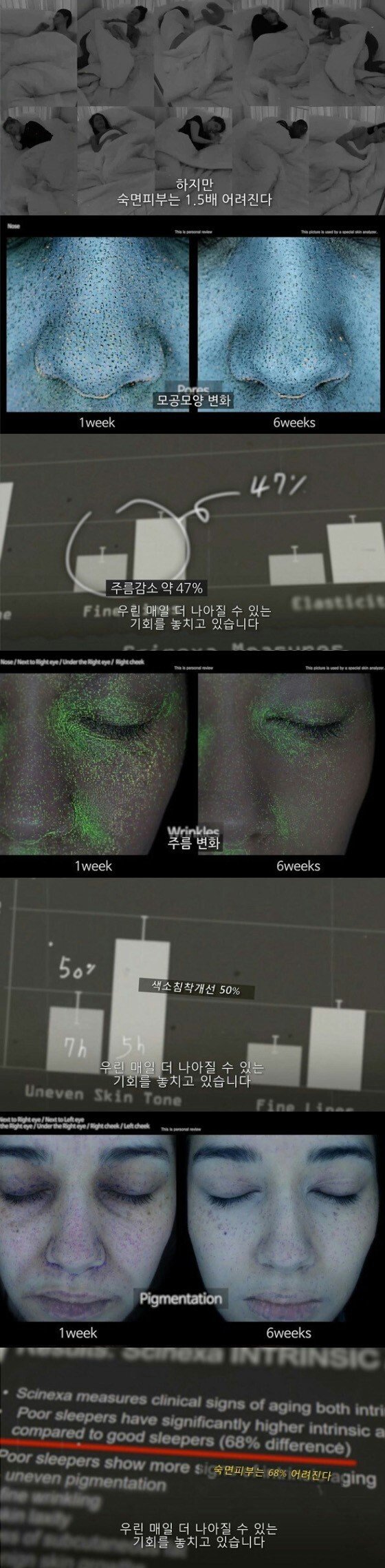 수면이 얼굴 외모에 미치는 영향