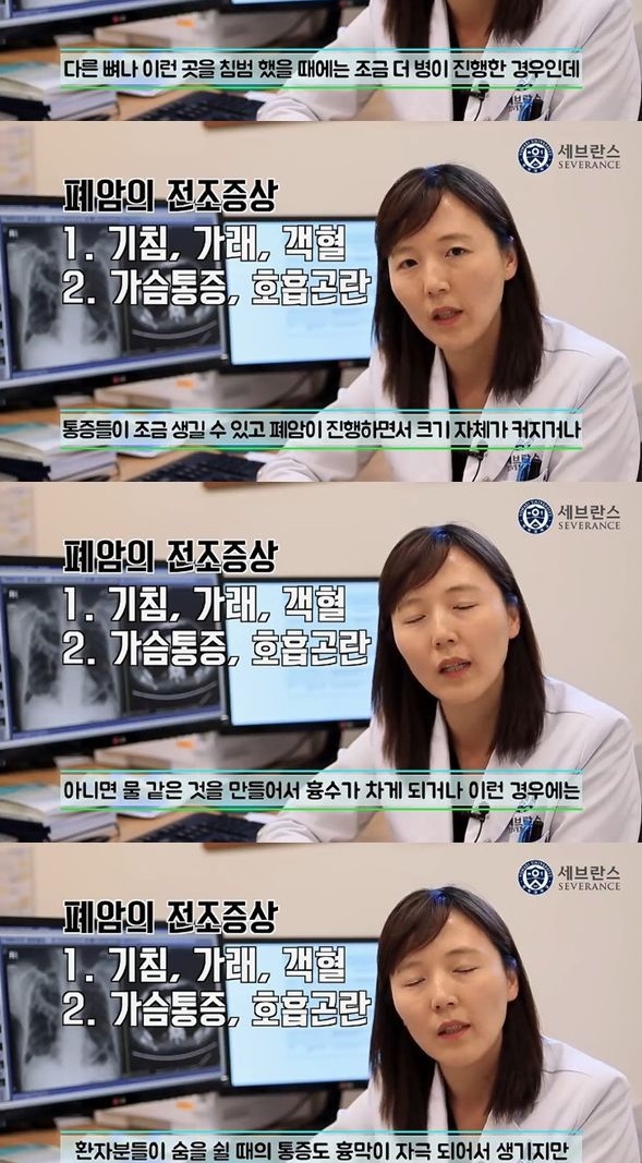 몸이 보내는 폐암 신호 4가지