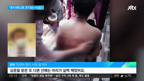 미얀마 감옥 참상..장기없는 시신까지..