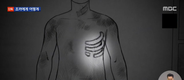 고문으로 죽은 10살 서연이.. 학대 내용