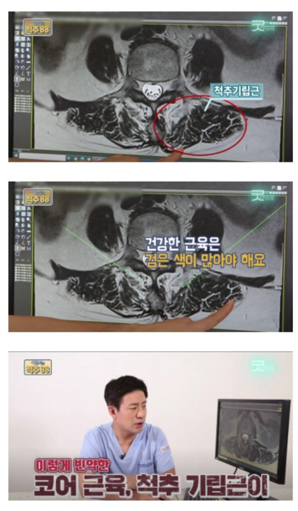 코어운동의 중요성