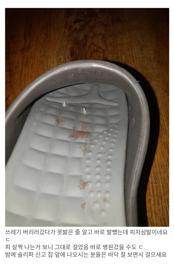 피자 삼발이 버릴때 조심하세요