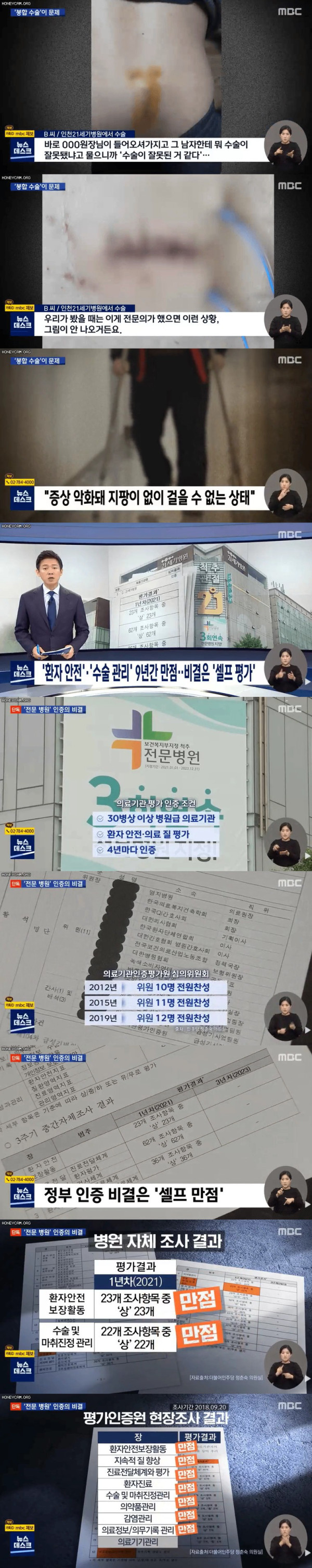 대리수술 병원 전직 간호사의 폭로