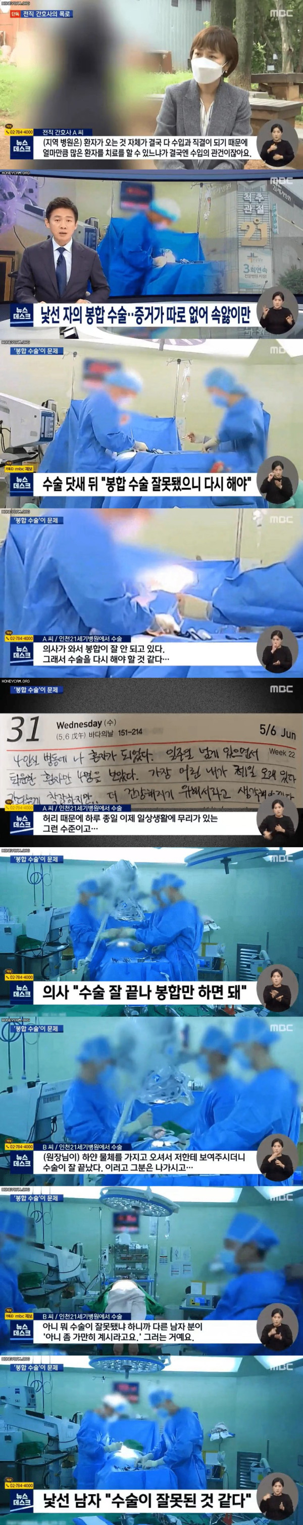 대리수술 병원 전직 간호사의 폭로