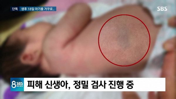 태어난 지 18일 된 신생아를 학대한 산후 도우미