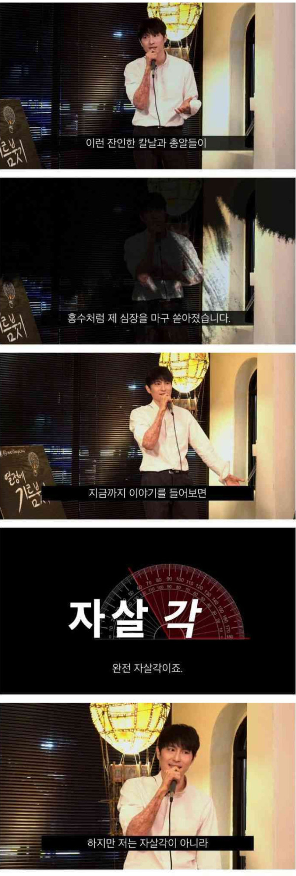 폭발사고로 전신 55% 화상을 입었던 남자...