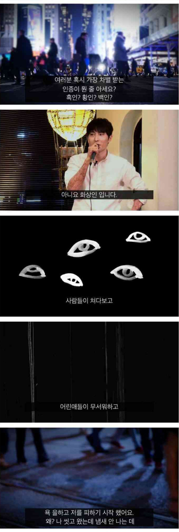 폭발사고로 전신 55% 화상을 입었던 남자...