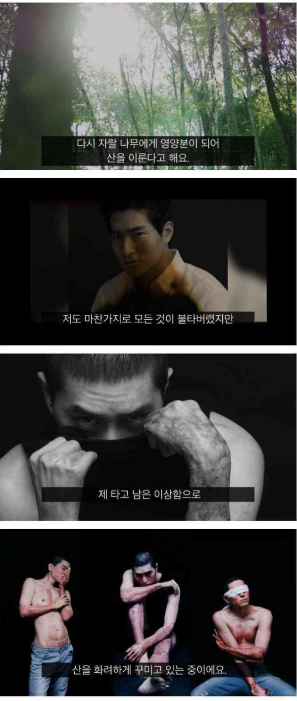 폭발사고로 전신 55% 화상을 입었던 남자...