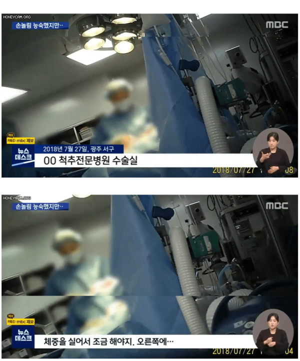 간호조무사가 대리 수술????