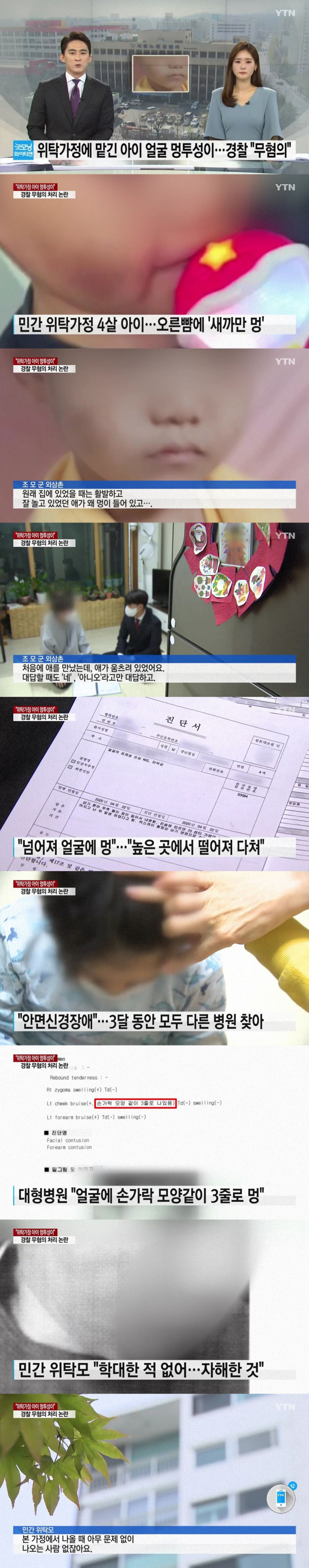위탁가정에 맡긴 아이 얼굴에 멍투성이...