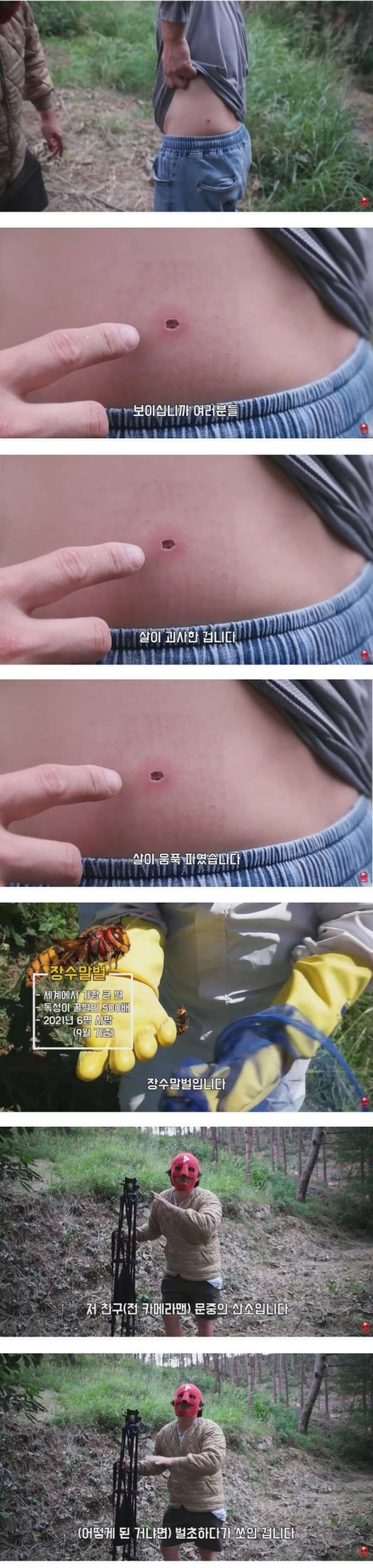 장수말벌에 쏘인 상처