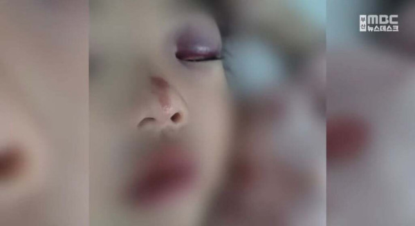 부산 백화점 문화센터 놀이기구 사고