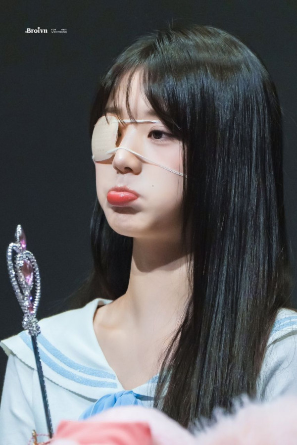 눈병 나서 안대를 쓴 아이브 장원영