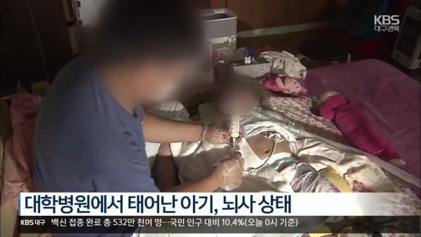 산무인과 산모 16시간 방치.. 신생아 뇌사 상태