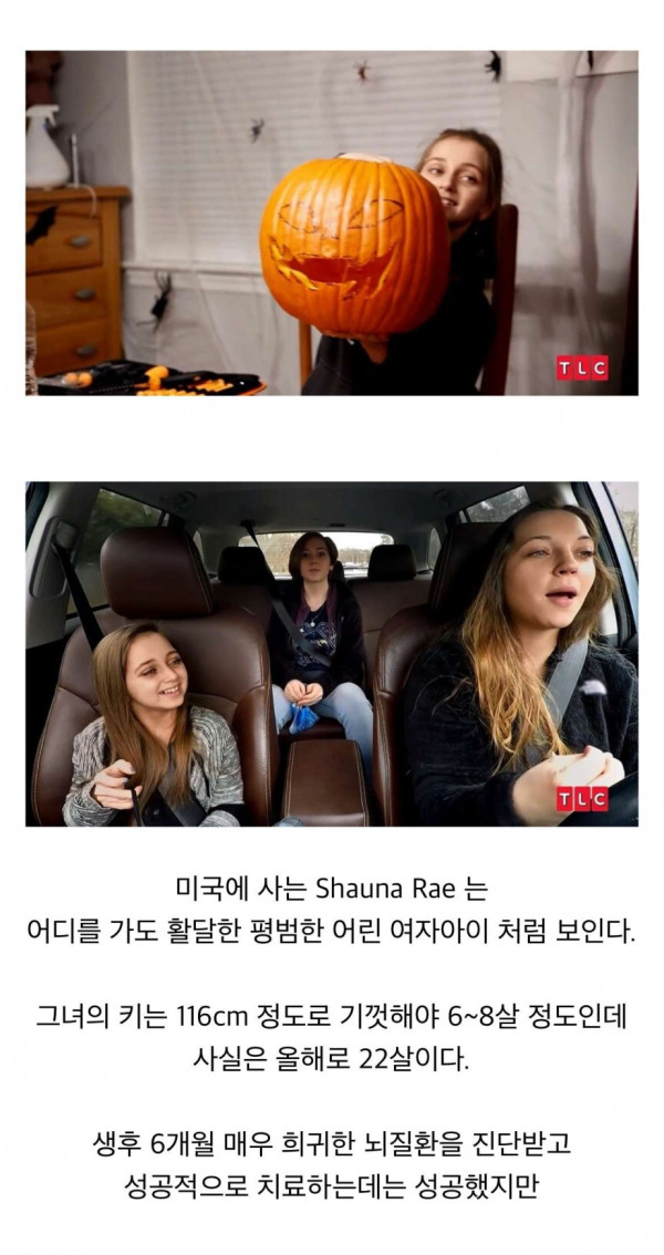 희귀병으로 8살 때 성장이 멈춰버린 22살 미국여성