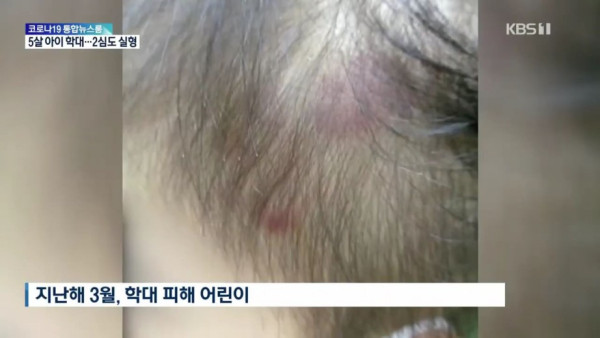 5살 아이를 학대한 외할머니와 친어머니