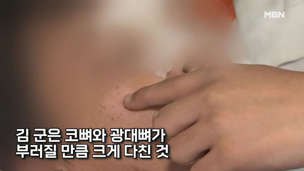 고등학교 선배들이 폭행하고 담뱃불로 지진 이유