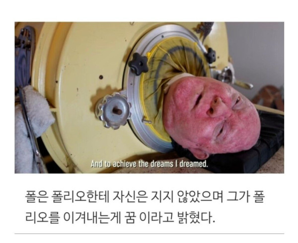 73년간 통 속에 살던 할아버지