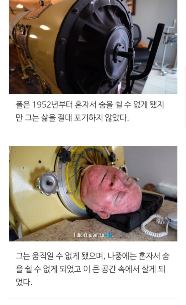 73년간 통 속에 살던 할아버지
