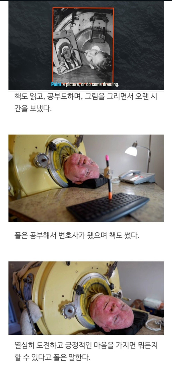 73년간 통 속에 살던 할아버지