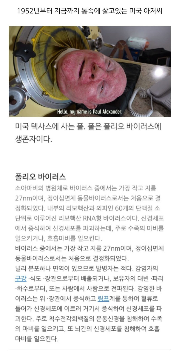 73년간 통 속에 살던 할아버지