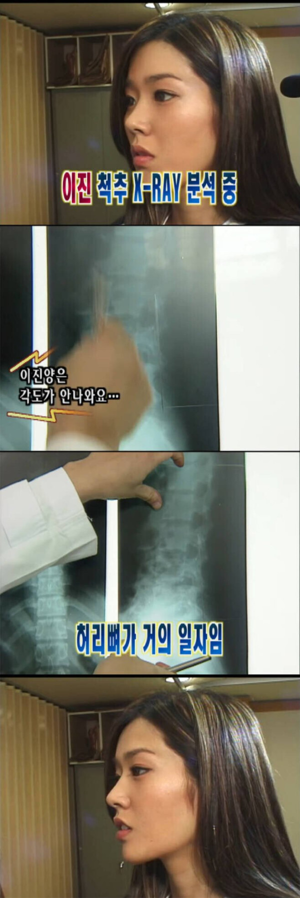 전설의 핑클 건강검진