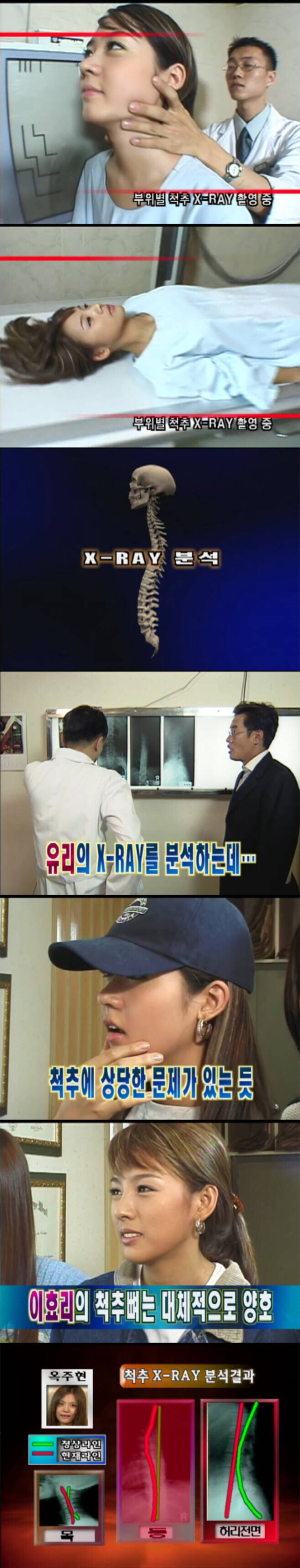 전설의 핑클 건강검진