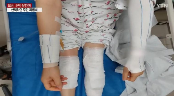 너구리들의 습격