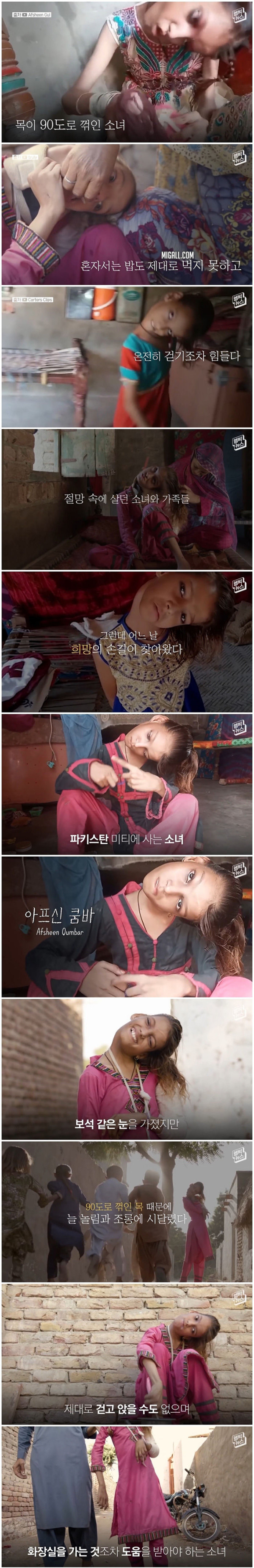 머리 꺾인 소녀의 사연이 알려진지 5년 만에 벌어진 기적