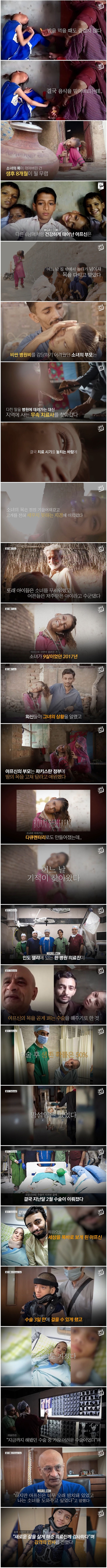 머리 꺾인 소녀의 사연이 알려진지 5년 만에 벌어진 기적