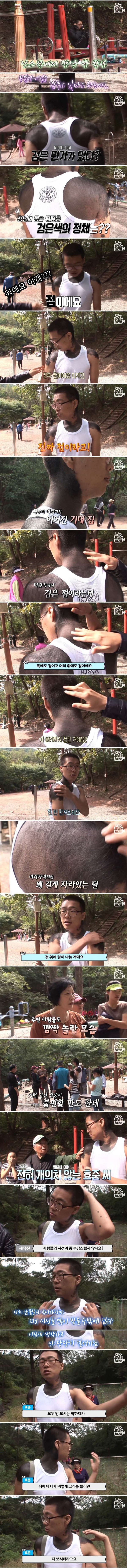목부터 등까지 온몸에 생긴 거대한 점