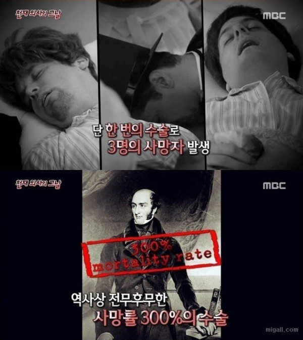 사망률 300% 수술