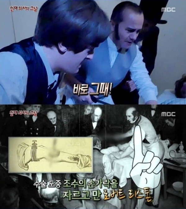 사망률 300% 수술
