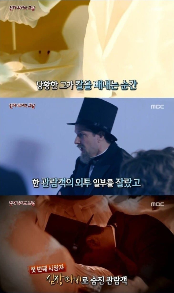 사망률 300% 수술