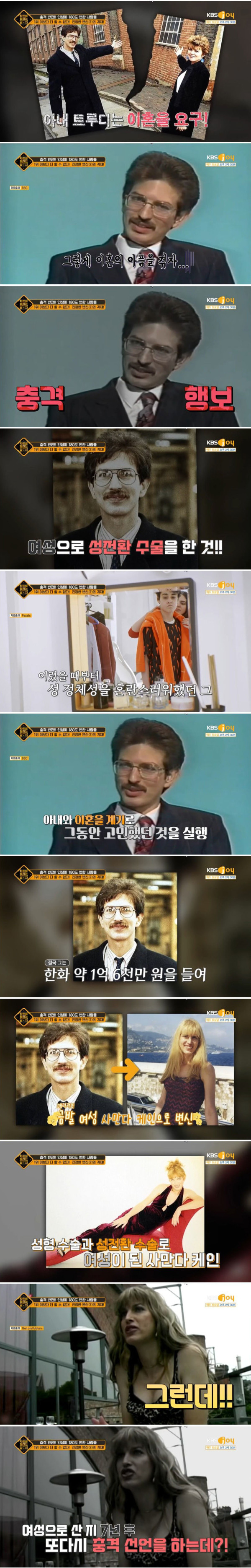 성전환 수술을 무려 3번이나 한 사람