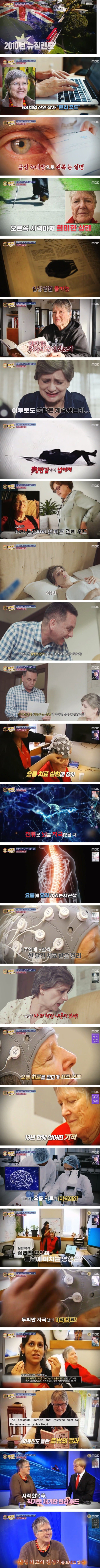요통 치료 실험에 참여했는데 시력 회복