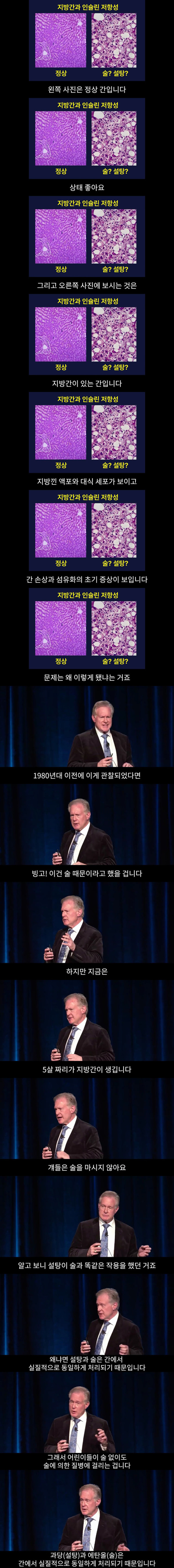 간수치 높은 사람들 필독!