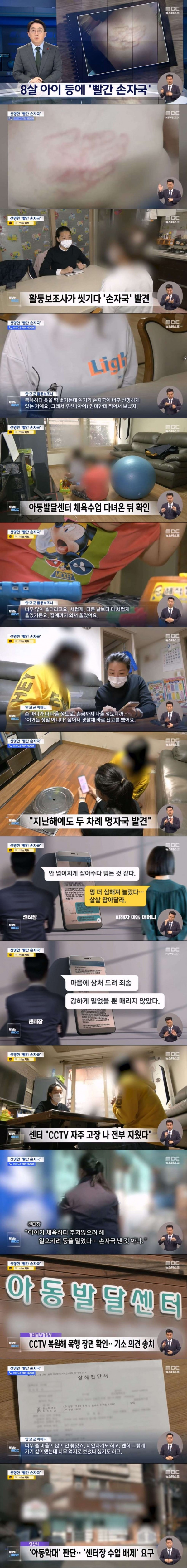 8살 장애아 등에 난 엄청난 손자국