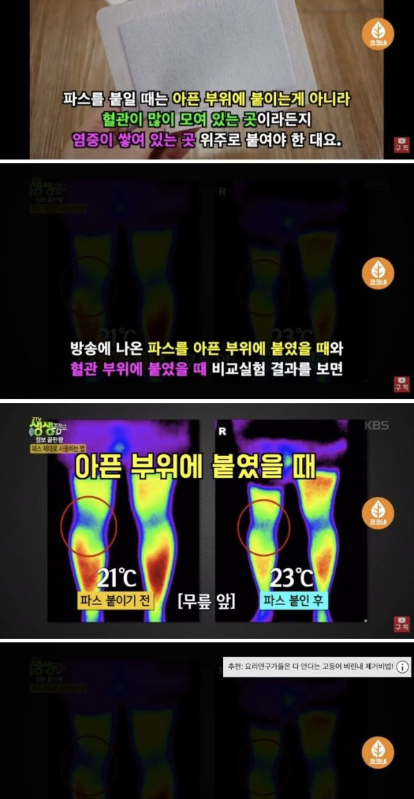 통증에 따라 파스 정확하게 붙이는 방법