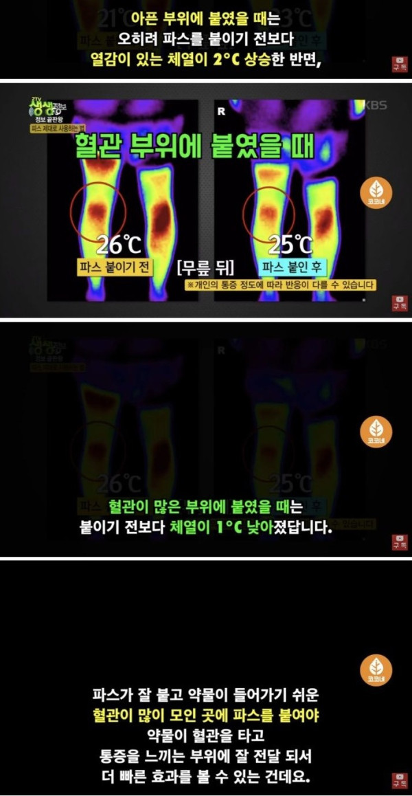 통증에 따라 파스 정확하게 붙이는 방법