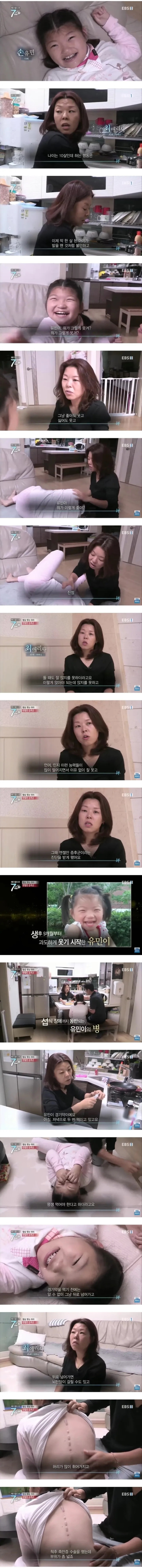 웃음을 참지 못하는 희귀병