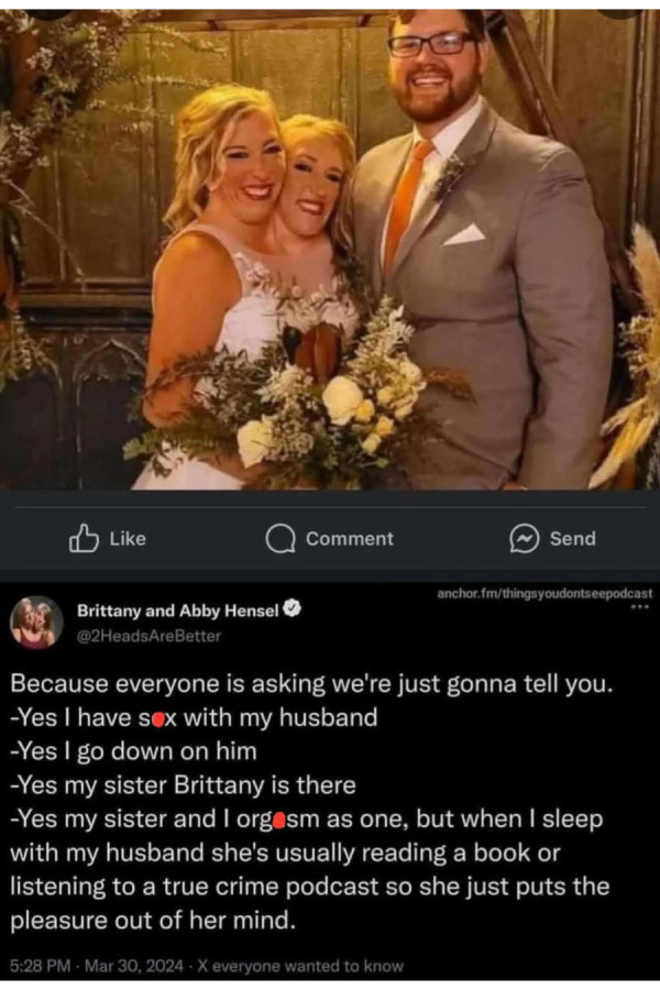 쌍두 샴쌍둥이랑 결혼한 남자