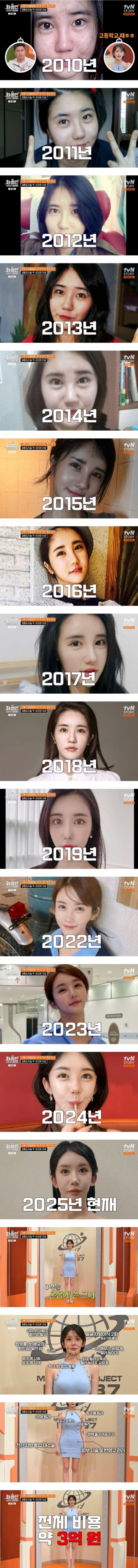 성형 수술에 3억을 썼다는 여성