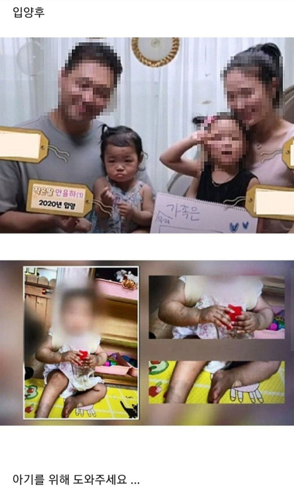 학대로 사망한 16개월 아기 입양 전/후 모습[학대범 얼굴 공개]