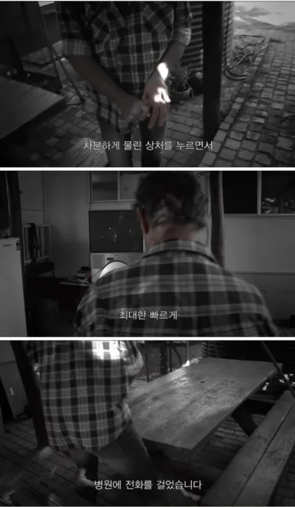 독사에게 물린 남자의 대처법