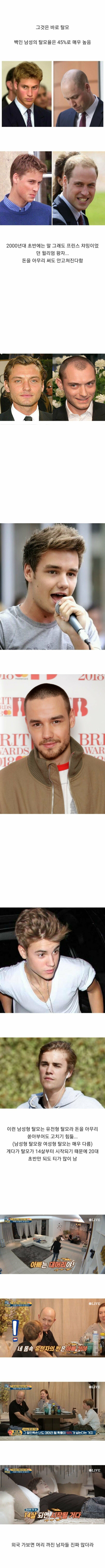 백인 남성 45%가 겪어야 할 미래