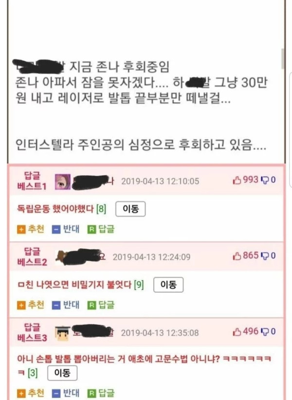 정형외과에서 마취도 없이 생으로 발톱 뽑은 썰